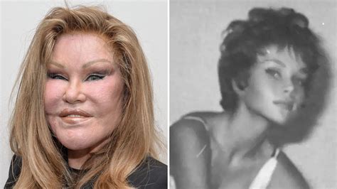 jocelyn wildenstein antes y después
